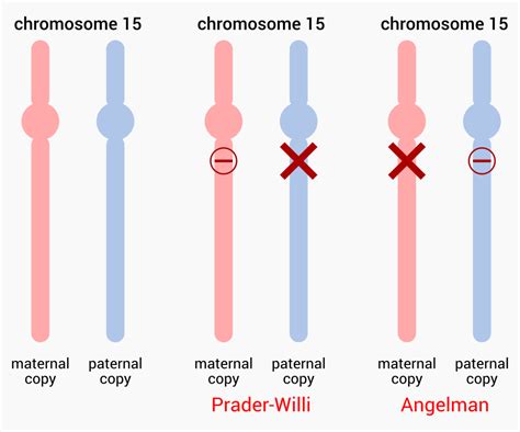 prader willi syndrome genetics.